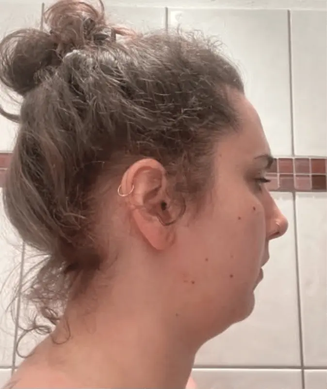 Teilnehmerin vorher im Profil, mit Haarknoten