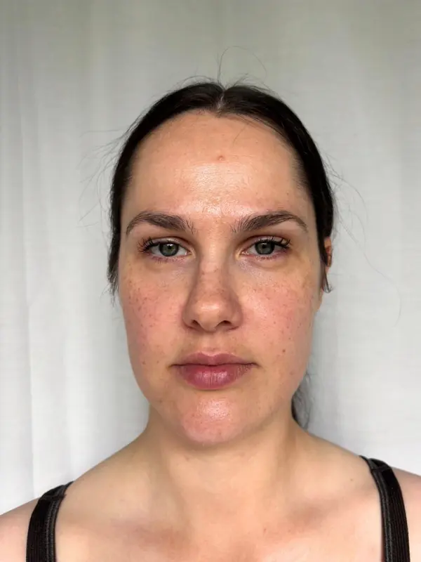 Teilnehmerin vorher, Gesicht von vorn