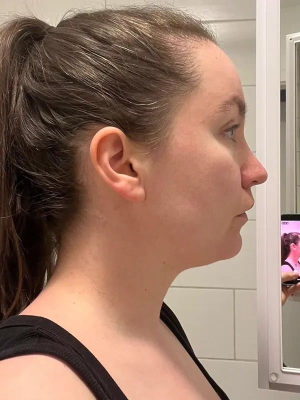 Teilnehmerin vorher im Profil, mit Zopf