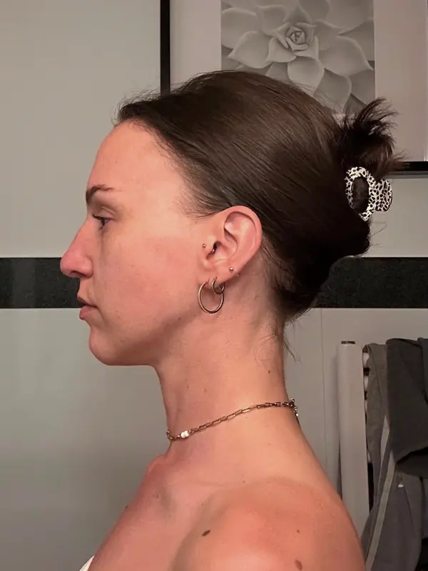 Teilnehmerin vorher im Profil
