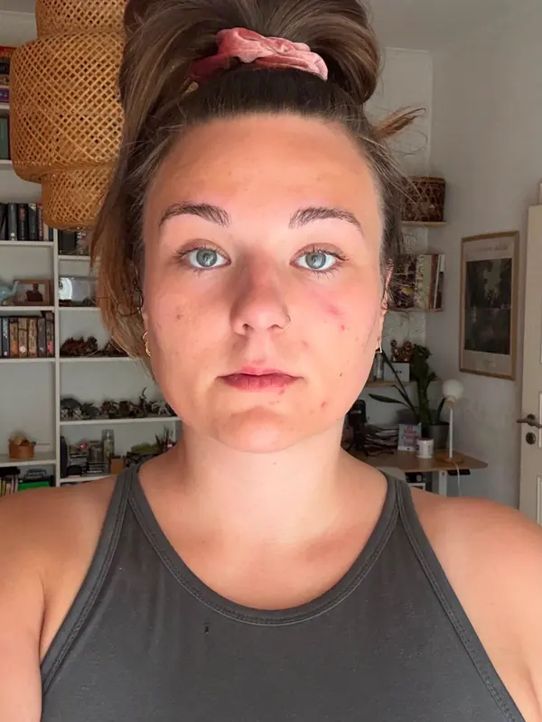 Dieselbe Teilnehmerin nachher, Gesicht von vorn