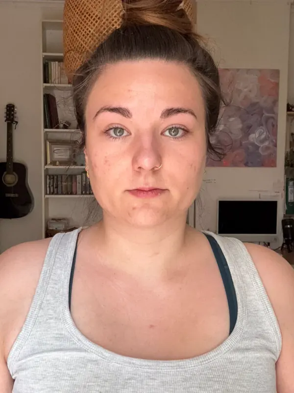 Teilnehmerin vorher, Gesicht von vorn